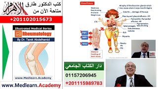 Rheumatoid Arthritis RA cme internalmedicine usmle medicalschool medical محاضراتباطنة [upl. by Burkhart]