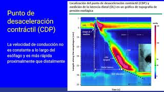 Manometría Esofágica de alta Resolución Parte I [upl. by Constantina]