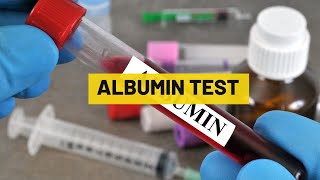 Albumin Test  My Lab Solution [upl. by Enram371]