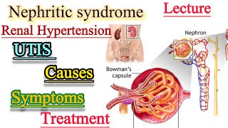 Nephritic syndromeUrinary Tract infectionsRenal Hypertensioncauses SymptomsTreatment [upl. by Liscomb]