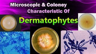 Morphology amp Colony Characteristic Of Dermatophytes [upl. by Othella20]