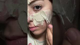 How to get rid of congested poreshow to get rid of blackheads [upl. by Elijah]