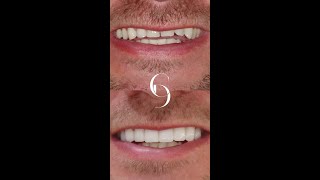 Smile Makeover  Cosmetique Dental [upl. by Barrington950]