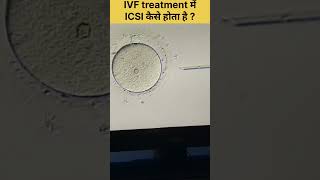 ICSI Procedure in IVF Intracytoplasmic sperm injection fertilitytreatment ivfjourney ivfsuccess [upl. by Yared599]