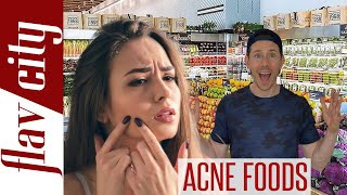 The WORST amp BEST Foods For Acne [upl. by Ashby]