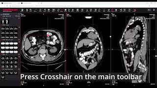 MedDream DICOM Viewer MPR feature [upl. by Kcim]