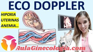 ECO DOPPLER EN OBSTETRICIA HIPOXIA ARTERIAS UTERINAS ANEMIA FETAL  Ginecología y Obstetricia [upl. by Short]