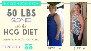 hCG Diet Interviews – Michelle lost 50 lbs despite Hashimoto’s and Fibromyalgia – Episode 55 [upl. by Dennard594]