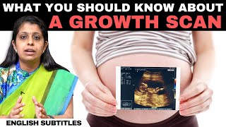 Growth Scan In Pregnancy  கரு வளர்ச்சி ஸ்கேன் பற்றி நீங்கள் தெரிந்து கொள்ள வேண்டிய விஷயங்கள் [upl. by Hayyikaz]