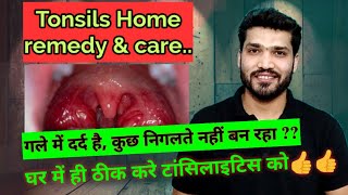 टॉन्सिलाइटिस घरेलू उपचार  Tonsillitis Home Remedies and care [upl. by Mccarthy]