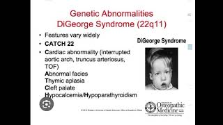 digeorge syndrome page116first aid USMLEFcps part1 preparation [upl. by Assyla]