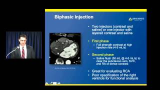 Cardiac CT How Do you do it [upl. by Seraphine]