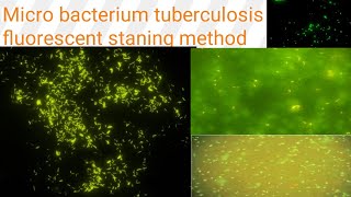 AuramineRhodamine staining on fluorescent microscopy Diagnosis of TB Microbacterium tuberculosis [upl. by Illac842]