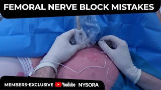 Femoral Nerve Block Common Mistakes  Crash course with Dr Hadzic [upl. by Naejamron]