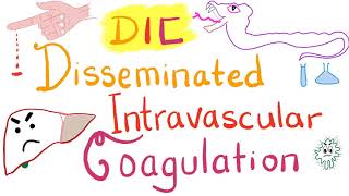 Disseminated Intravascular Coagulation DIC [upl. by Melisande]