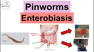 Pinworms Enterobiasis  Infection Transmission Symptoms Diagnosis Treatment [upl. by Nibuz589]