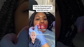 Lip Blushing GONE WRONG  Plastic Surgeon Reacts [upl. by Fruin506]