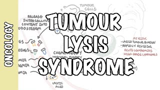 Tumour Lysis Syndrome Tumor Lysis Syndrome  pathophysiology diagnosis and treatment [upl. by Ekle]