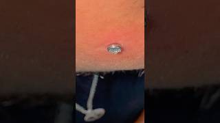 Microdermal Aplicado piercingcartilagem piercings piercingorelha piercingnariz earrings fashio [upl. by Niuqauj557]