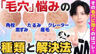 【あなたの毛穴悩みはどのタイプ？】毛穴悩みの種類と解決法！効くスキンケア＆美容医療を解説！【角栓・黒ずみ・たるみ・クレーター・産毛】 [upl. by Burnie]