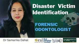 Role of Forensic Odontologist in Human IdentificationOral pathologyFundamental Series [upl. by Morez]