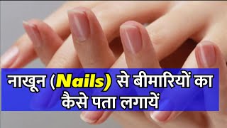 नाखून Nails से बीमारियों का कैसे पता लगायें palmistryhastrekhaastrologyanilkaushalastrologer [upl. by Shyamal]