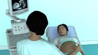 The Basic Steps of an Obstetric Ultrasound Examination [upl. by Jarvis992]