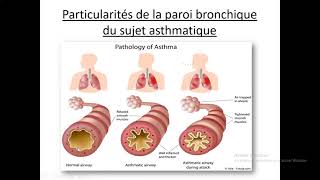 14Asthme Dr Djali BEO  Pneumo [upl. by Hcib]