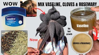 WOW 😮 Mix VASELINE with CLOVES amp ROSEMARY amp Grow Hair Like Never Before 10x FASTER [upl. by Kcirted]