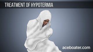 Treatment of Hypothermia [upl. by Assiluy]