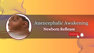 Exploring Reflexes in Babies with Anencephaly [upl. by Latsryk704]