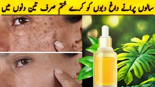 How to remove dark spot in 3 days  How to get rid dark spots with home remedy  skin care [upl. by Sitnalta]