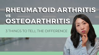 Osteoarthritis vs Rheumatoid arthritis 3 Things to tell the difference [upl. by Cleve]