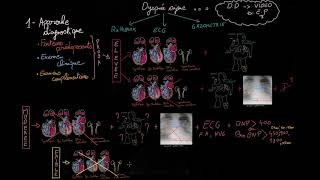 Insuffisance cardiaque aiguë en 3 étapes  Partie 1  Docteur Synapse [upl. by Lanti]