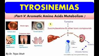 Tyrosinemias II Inborn errors of Aromatic Amino Acids Metabolism II Biochemistry II Dr Tejas Shah [upl. by Hatokad731]