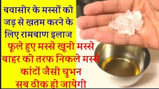 bawaseer ka ilajelajbawaseer ki dawaibawaseer ke masse बवासीर के मस्सों का इलाज home remedy [upl. by Eilhsa]