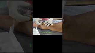 Sports Medicine Injection Platelet Rich Plasma for Osgood Schlatter Disease by Dr Shikha [upl. by Trudnak]