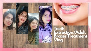 BRACES TREATMENT EXPERIENCE AND TEETH EXTRACTION [upl. by Mazman]