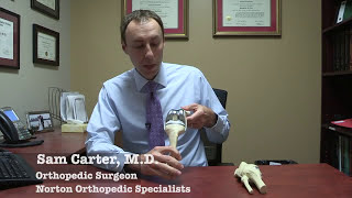 What is a partial knee replacement [upl. by Giusto]