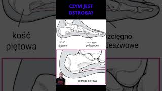 Ostroga piętowa W praktyce anatomia stopa ostroga podeszwa [upl. by Cinda]