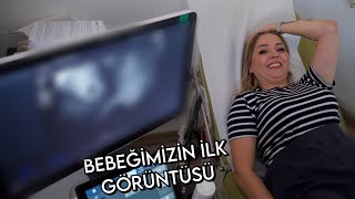 BEBEĞİMİZİN İLK KONTROLÜ  BEBEĞİMİZİ GÖRDÜK [upl. by Eenor372]