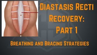 Diastasis Recti Recovery Part 1 Breathing and Bracing Strategies [upl. by Ecirtnom733]