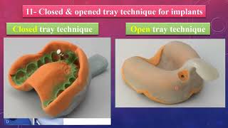 11 Closed amp Open Tray Indirect amp Direct Impression Techniques for Implant [upl. by Naryk]