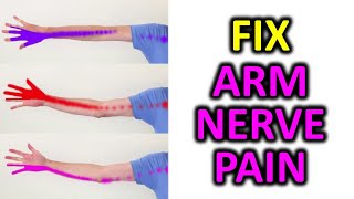 3 Exercise To Relieve Arm Pain Numbness Pins and Needles [upl. by Memory]