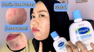 REVIEW CETAPHIL GENTLE SKIN CLEANSER 3 BULAN PAKAI  BREAKOUT DONG [upl. by Bobbye]