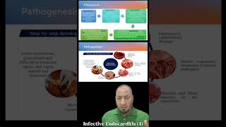 Infective Endocarditis 4 pathogenesis التهاب الشغاف المعدي microbiology medicalstudent [upl. by Conrad]