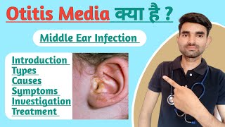 Otitis Media in Hindi  Types Causes Symptoms and Treatment of Otitis Media [upl. by Erolyat298]