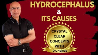 Causes of Hydrocephalus  What is going on in the brain  Dr Najeeb [upl. by Vlada]