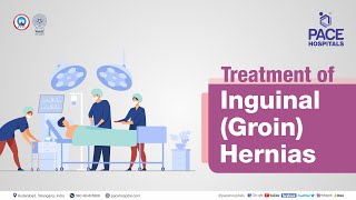 Treatment for Inguinal Hernia  PACE Hospitals Shortvideo inguinalhernia [upl. by Annaegroeg]