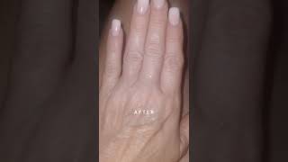 I Used a Fascia Blaster on My Hands and THIS Is What Happened  Before and After [upl. by Whitver382]